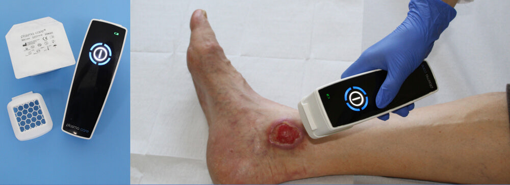 ulcer varicos, picior diabetic, eczeme, eczema, arsuri, chirurgie diabet, infectii nozocomiale, plaga deschisa, plaga, cicatrici, basici, taieturi, fractura, ulcer