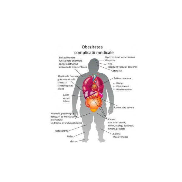 Diagnosticarea ,complicațiile și prevenirea obezității