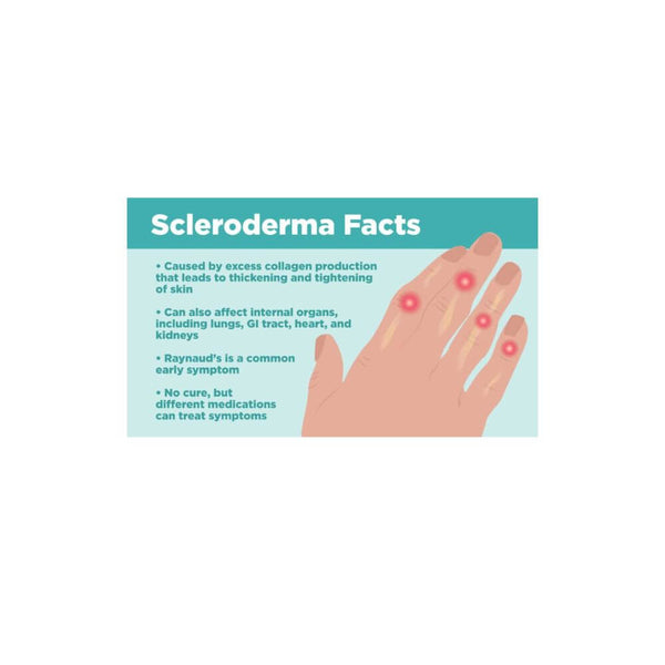 Sclerodermie