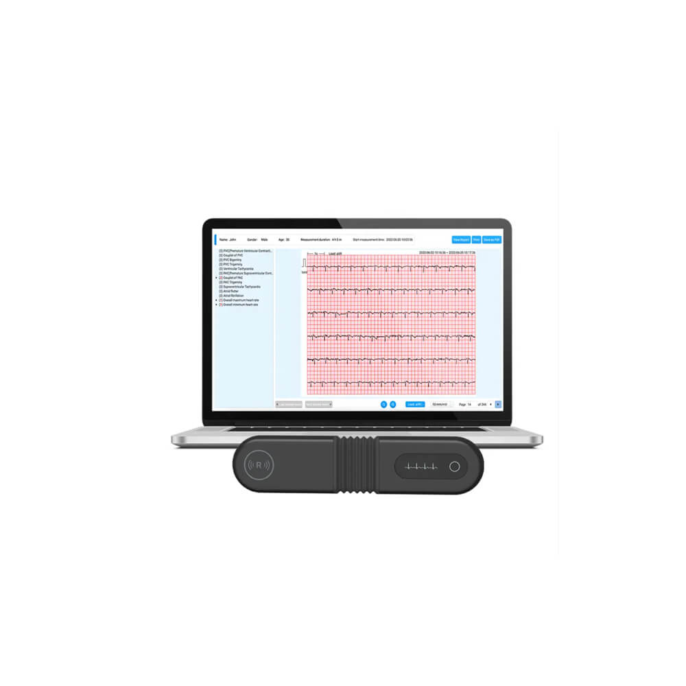 holter ekg 72 ore monitorizare ekg continuu, Defiro