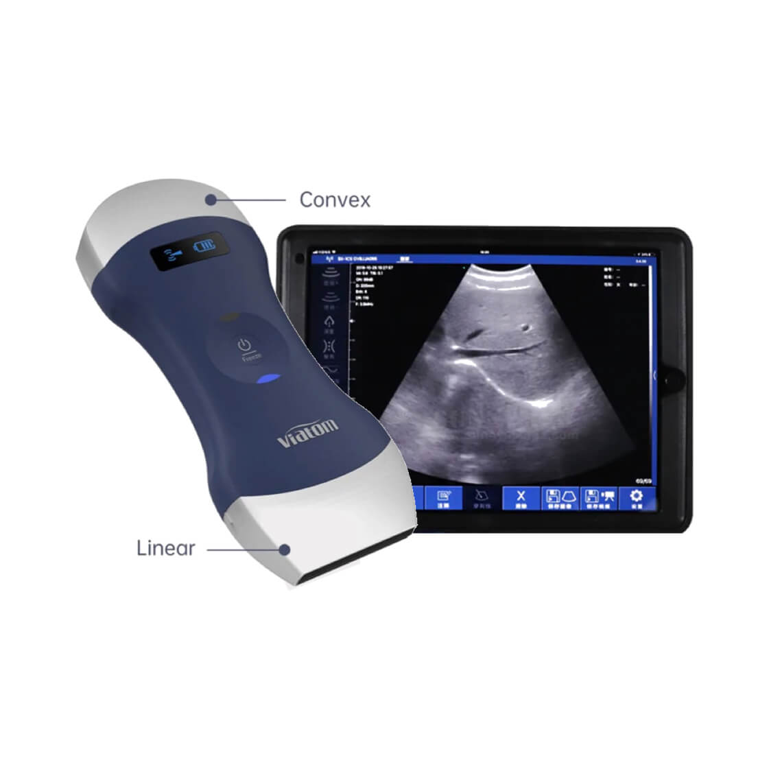 Ecograf doppler, portabil, dual + cardio, Liniar si Convex, avizat medical - DEFIRO, ecograf , ecograf wireless, ecograf portabil, ecografie abdominala, cursuri ecografie