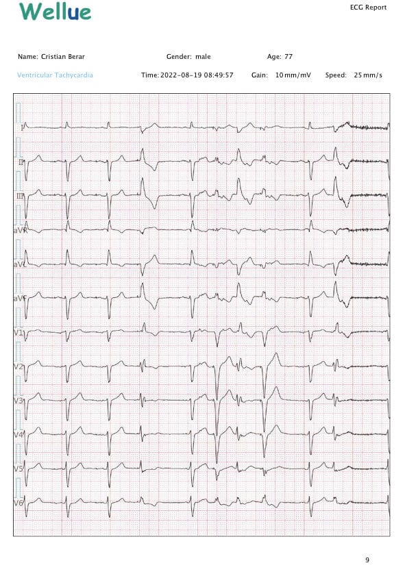 Holter EKG, 12 derivatii, profesional, cu interpretare avizata medical - DEFIRO