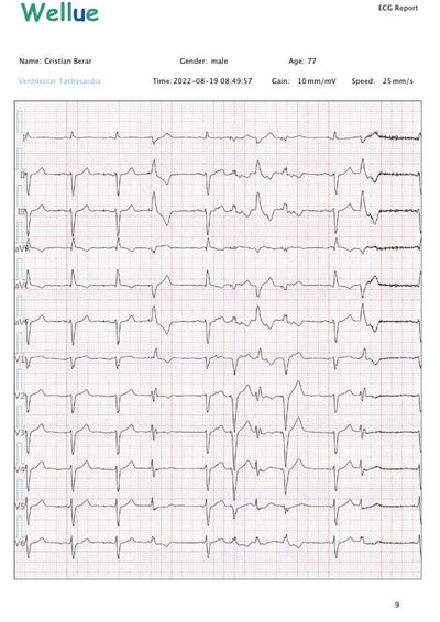 Holter EKG, 12 derivatii, profesional, cu interpretare avizata medical - DEFIRO