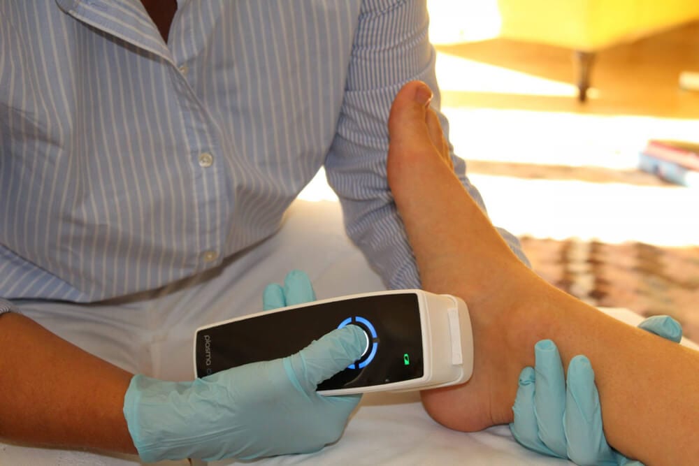 Vindecarea escarelor, picior diabetic cu Plasma la rece - DEFIRO
